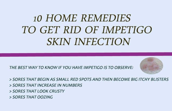 Home Remedies to Get Rid of Impetigo Skin Infection
