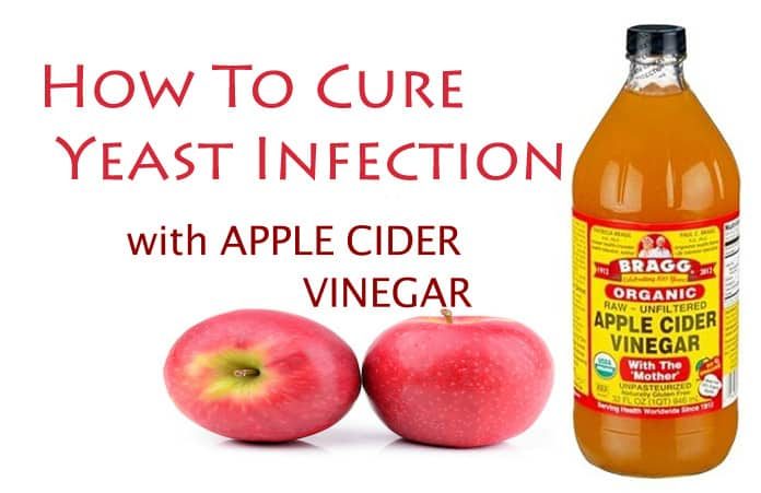 How To Use Apple Cider Vinegar For Yeast Infection Cure?